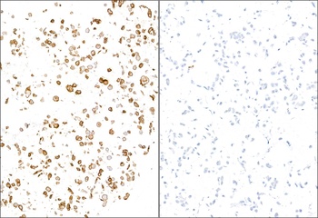 Rabbit anti-E-Selectin/CD62E Recombinant Monoclonal Antibody