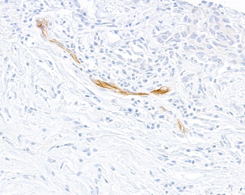 E-Selectin/CD62E Antibody