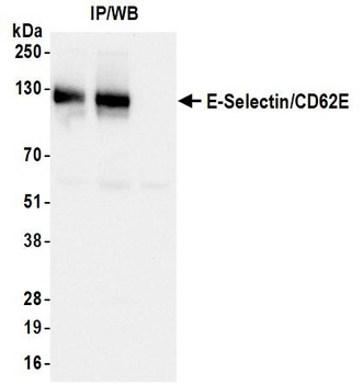 Rabbit anti-E-Selectin/CD62E Recombinant Monoclonal Antibody