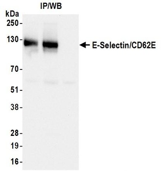 E-Selectin/CD62E Antibody