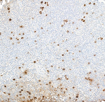 Rabbit anti-IgM Recombinant Monoclonal Antibody
