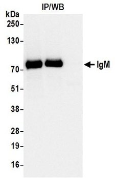 IgM Antibody