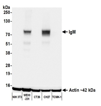 IgM Antibody