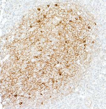 Rabbit anti-IgM Recombinant Monoclonal Antibody