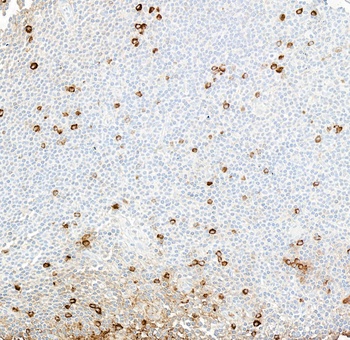 IgM Antibody