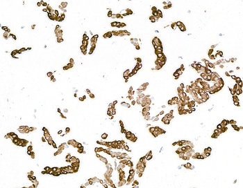 Mouse anti-Cytokeratin 14 Recombinant Monoclonal Antibody