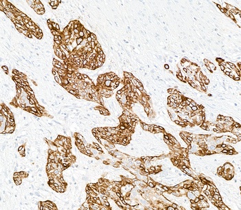 Mouse anti-Cytokeratin 14 Recombinant Monoclonal Antibody