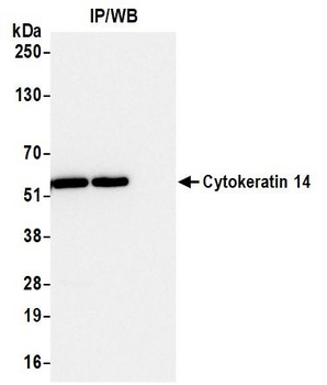 Cytokeratin 14 Antibody