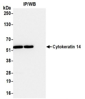 Mouse anti-Cytokeratin 14 Recombinant Monoclonal Antibody