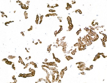 Cytokeratin 14 Antibody