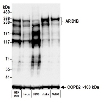ARID1B Antibody