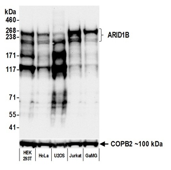 Rabbit anti-ARID1B Recombinant Monoclonal Antibody