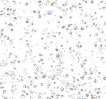 Rabbit anti-ARID1B Recombinant Monoclonal Antibody