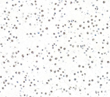 Rabbit anti-ARID1B Recombinant Monoclonal Antibody