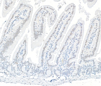 Rabbit anti-ARID1B Recombinant Monoclonal Antibody