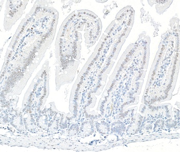 ARID1B Antibody