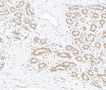 Rabbit anti-ARID1B Recombinant Monoclonal Antibody