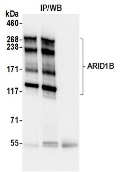 Rabbit anti-ARID1B Recombinant Monoclonal Antibody
