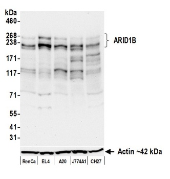 Rabbit anti-ARID1B Recombinant Monoclonal Antibody