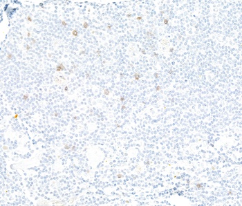 NKG2A Antibody