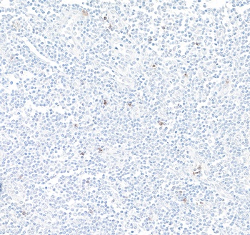 NKG2A Antibody