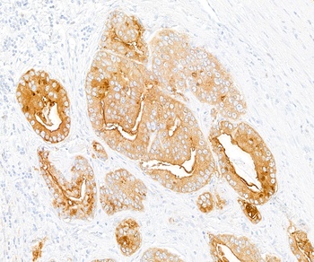 Rabbit anti-DPP4/CD26 Recombinant Monoclonal Antibody