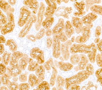 Rabbit anti-DPP4/CD26 Recombinant Monoclonal Antibody