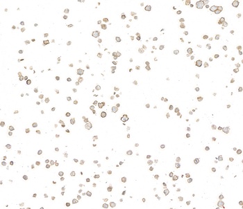 CD39 Antibody