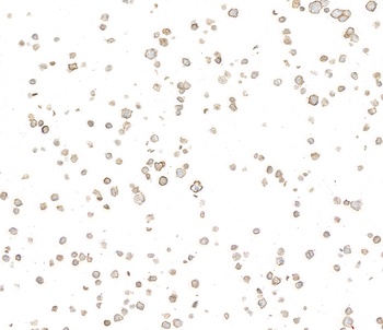 Rabbit anti-CD39 Recombinant Monoclonal Antibody