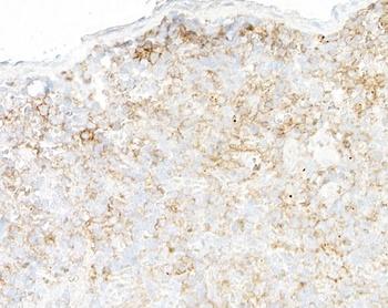 Rabbit anti-CD39 Recombinant Monoclonal Antibody