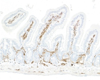 Rabbit anti-CD39 Recombinant Monoclonal Antibody