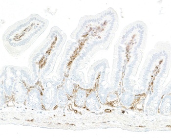 CD39 Antibody