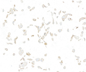 Rabbit anti-Met Recombinant Monoclonal Antibody