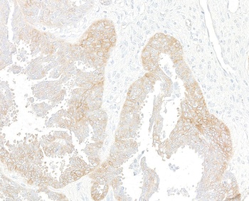 Rabbit anti-Met Recombinant Monoclonal Antibody