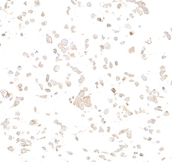 Rabbit anti-Met Recombinant Monoclonal Antibody