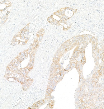 Rabbit anti-Met Recombinant Monoclonal Antibody