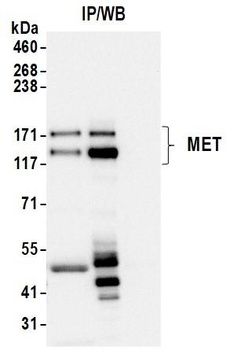 Rabbit anti-Met Recombinant Monoclonal Antibody