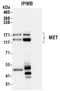 Met Antibody