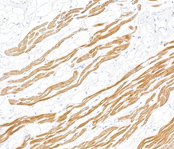 Rabbit anti-Troponin I Recombinant Monoclonal Antibody