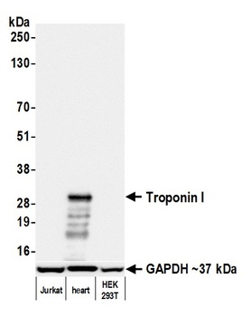 Rabbit anti-Troponin I Recombinant Monoclonal Antibody