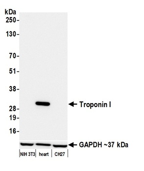 Troponin I Antibody