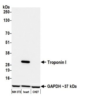 Rabbit anti-Troponin I Recombinant Monoclonal Antibody