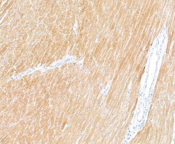 Rabbit anti-Troponin I Recombinant Monoclonal Antibody