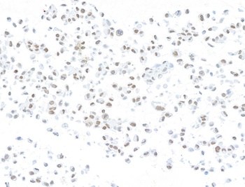 ARID1A/BAF250 Antibody