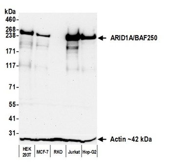ARID1A/BAF250 Antibody