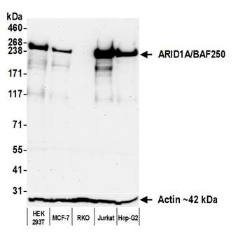 Rabbit anti-ARID1A/BAF250 Recombinant Monoclonal Antibody