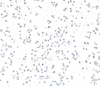 Rabbit anti-ARID1A/BAF250 Recombinant Monoclonal Antibody