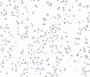 ARID1A/BAF250 Antibody