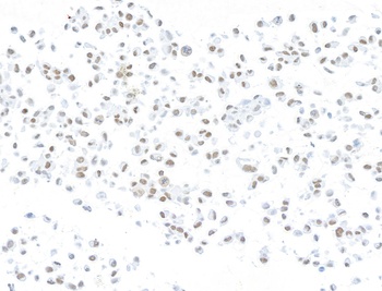 Rabbit anti-ARID1A/BAF250 Recombinant Monoclonal Antibody