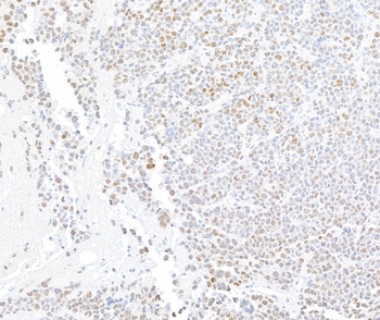 Rabbit anti-ARID1A/BAF250 Recombinant Monoclonal Antibody